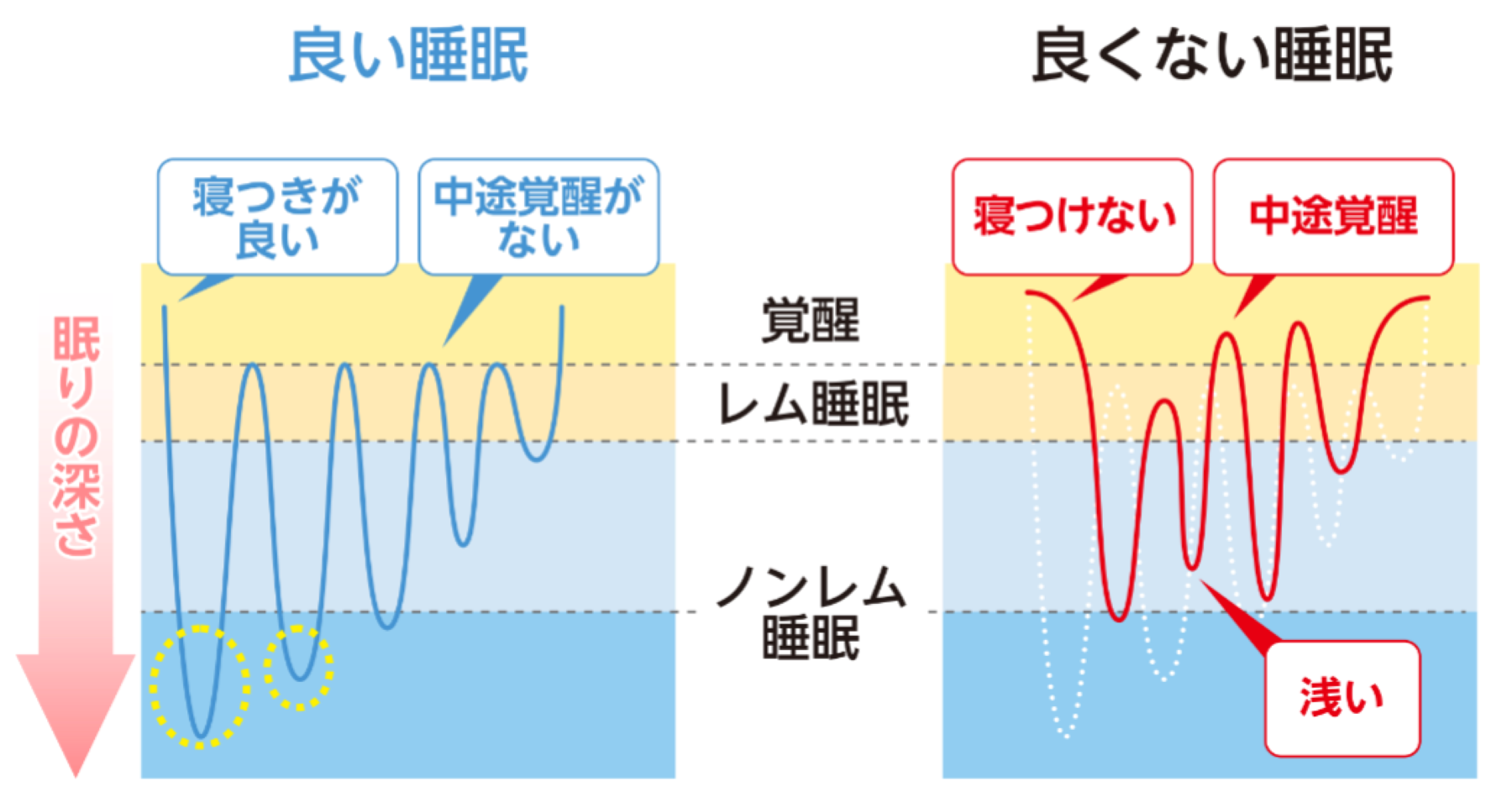 睡眠の段階とは何ですか?